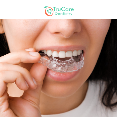 Are Invisalign Braces the Best Option for Overbite Treatment? – TruCare  Dentistry