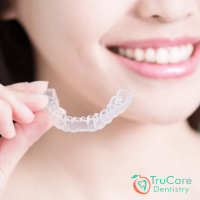 Benefits of Invisalign Braces Treatment – TruCare Dentistry